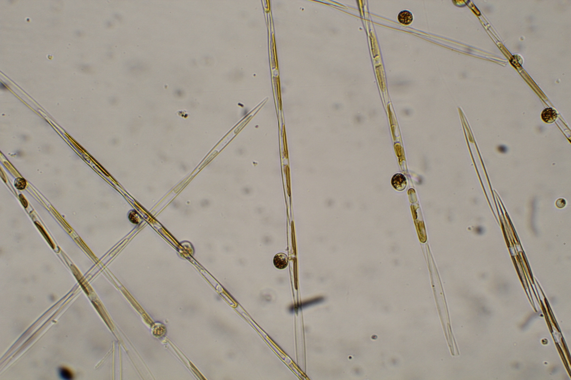  Pseudo-nitzschia, the diatom that produces toxic domoic acid, collected off the Oregon Coast in May. NOAA Fisheries/NWFSC